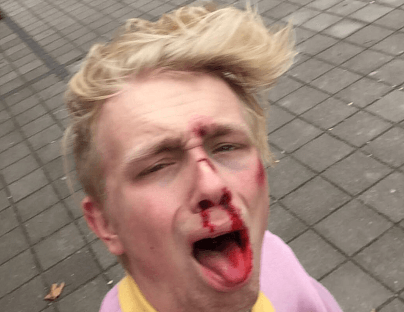 de broer van Joost Klein is zijn manager